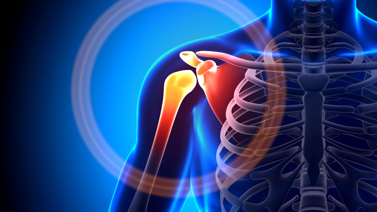 Common Shoulder Injuries Nebraska Orthopaedic Center