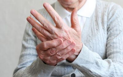 Arthritis: What is it And How to Live With it, Part ll